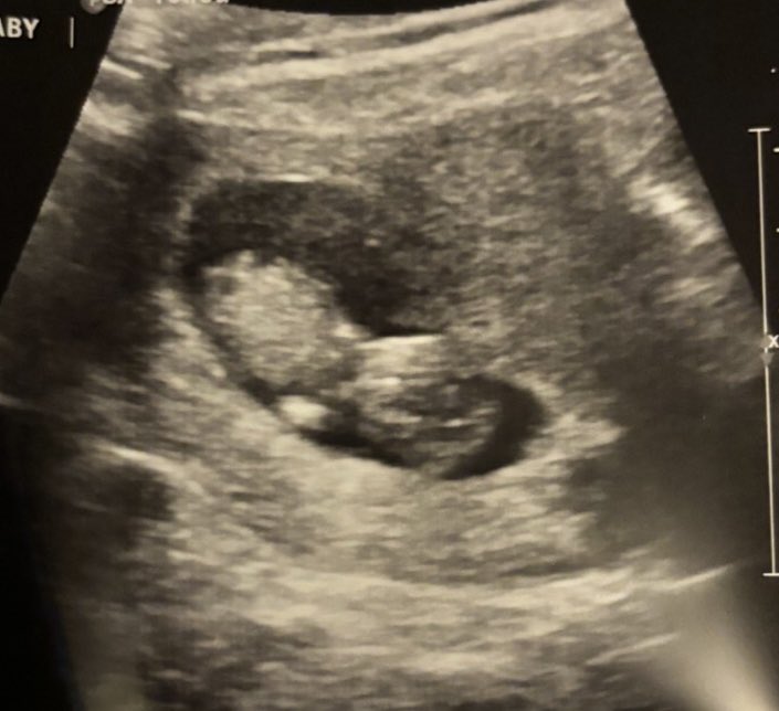 my baby luna. mommy can’t wait for you to be here 💗