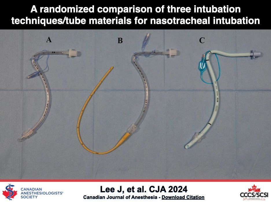 A randomized comparison of three intubation techniques/tube materials for nasotracheal intubation - Canadian Journal of Anesthesia #CJA2024 #Anesthesia #Anesthesiology buff.ly/49me65D