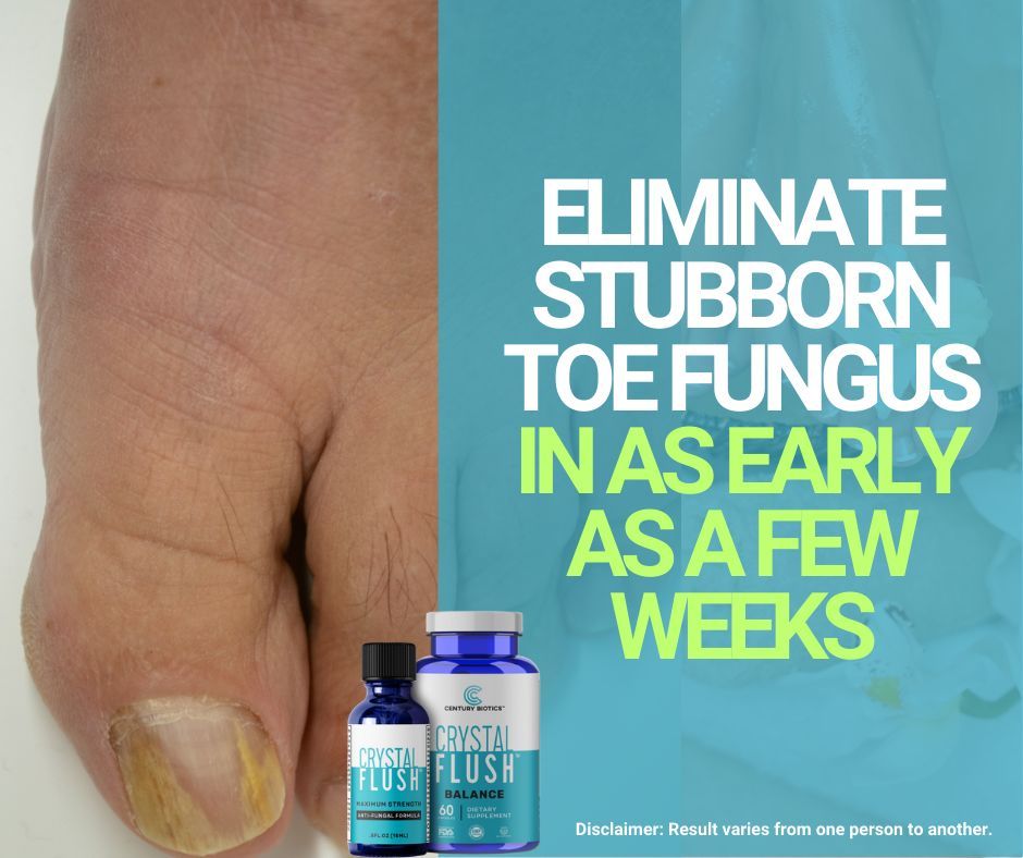 Say goodbye to stubborn toe fungus with Crystal Flush's 2-Step System! Our powerful Antifungal Serum penetrates deep into the nail bed, eliminating fungus at its source. Combine it with Crystal Flush Balance for complete fungal defence from w/in. Shop → buff.ly/3Uj68EV.