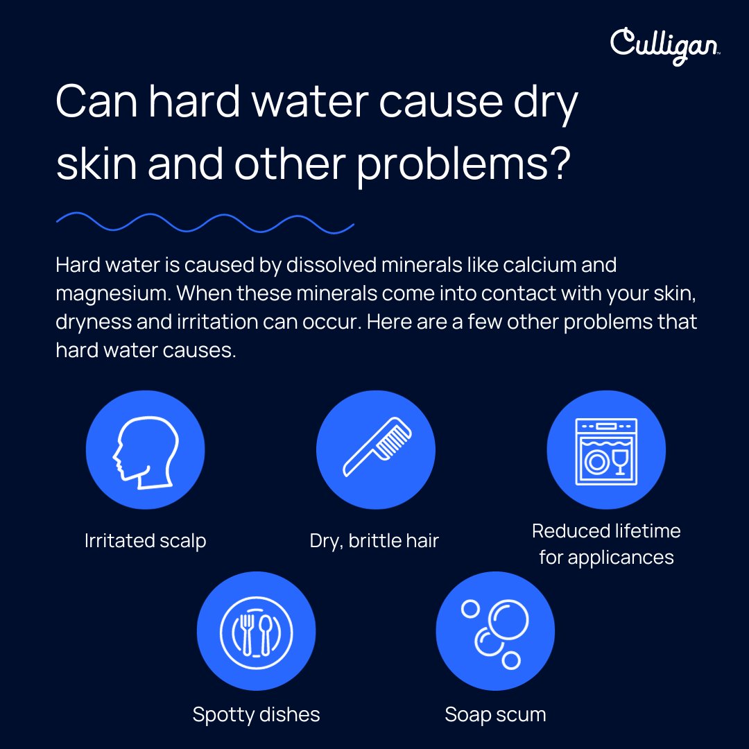 Can hard water cause dry skin and other problems? Learn more here: tinyurl.com/ycxueyab 

#Culligan #WaterCo #WaterQuality #CleanWater #HealthyHome #WaterPurification #WaterTreatment #FilterYourWater #PureWater #HydrationMatters #BetterWaterBetterLife #WaterWellness