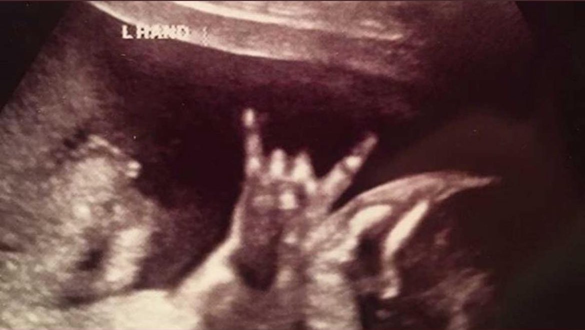 Just found my first ever picture 🥹