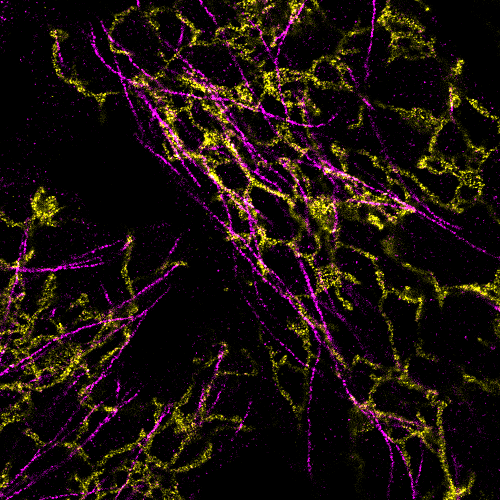 simone_mortal's tweet photo. Amazing iU-ExM gel at @SLN_ICFO  still fluorescent after one week in my backpack, definetly not bad 😁
Great staining of endoplasmic reticulum and tubulin @MarineLaporte8 and @louvel_vincent
#EMBOExM #UExM https://t.co/tfFMHkt9VA