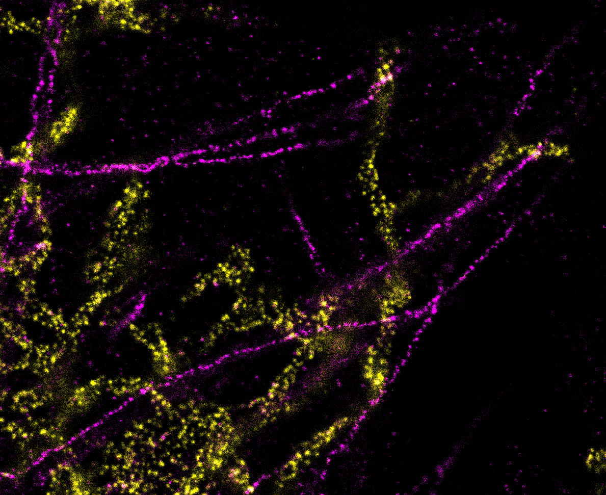 Amazing iU-ExM gel at @SLN_ICFO still fluorescent after one week in my backpack, definetly not bad 😁 Great staining of endoplasmic reticulum and tubulin @MarineLaporte8 and @louvel_vincent #EMBOExM #UExM
