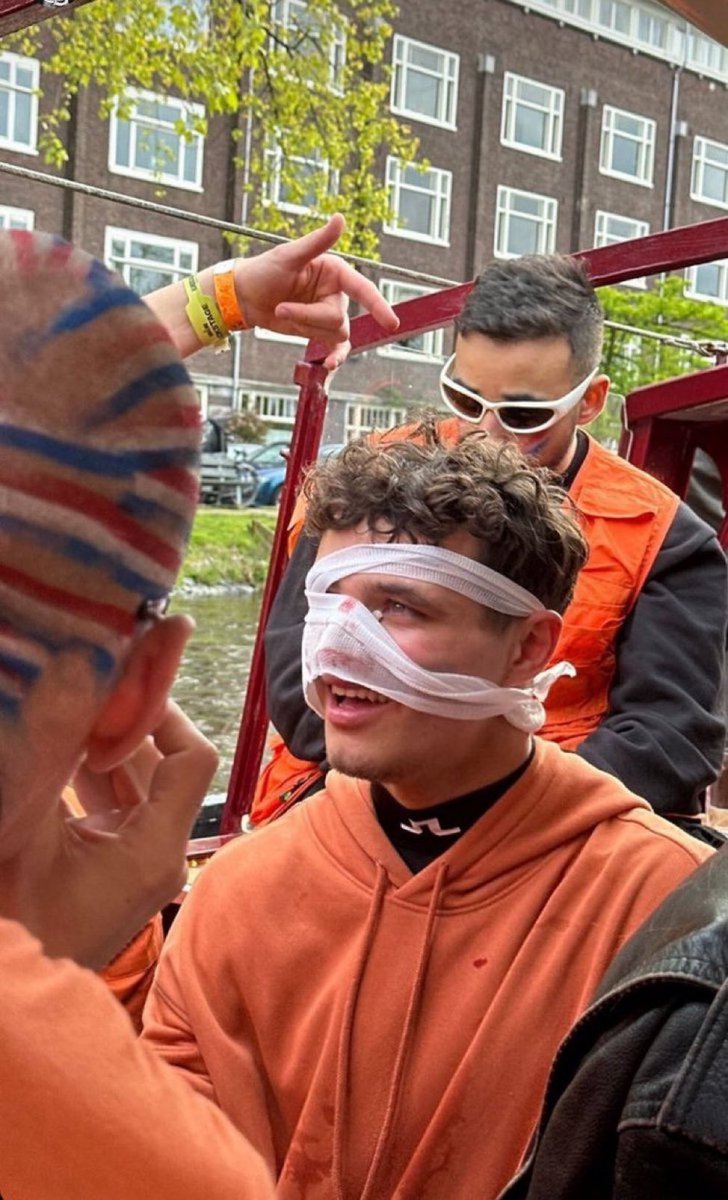 🤕 Lando Norris, Amsterdam'da katıldığı Kral Gününde yaralandı. Burnunun kırıldığı konuşuluyor.