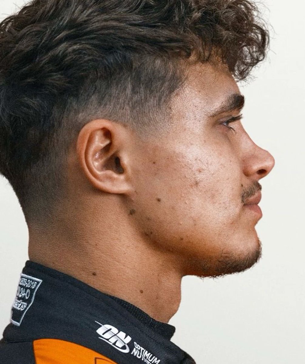 lando norris rhinoplasty reveal