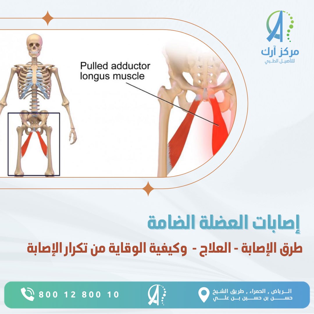 Arcrehab's tweet photo. إصابات العضلة الضامة، طرق الإصابة، العلاج وكيفية الوقاية من تكرار الإصابة

#مركز_آرك_للتأهيل_الطبي https://t.co/gv72naX726