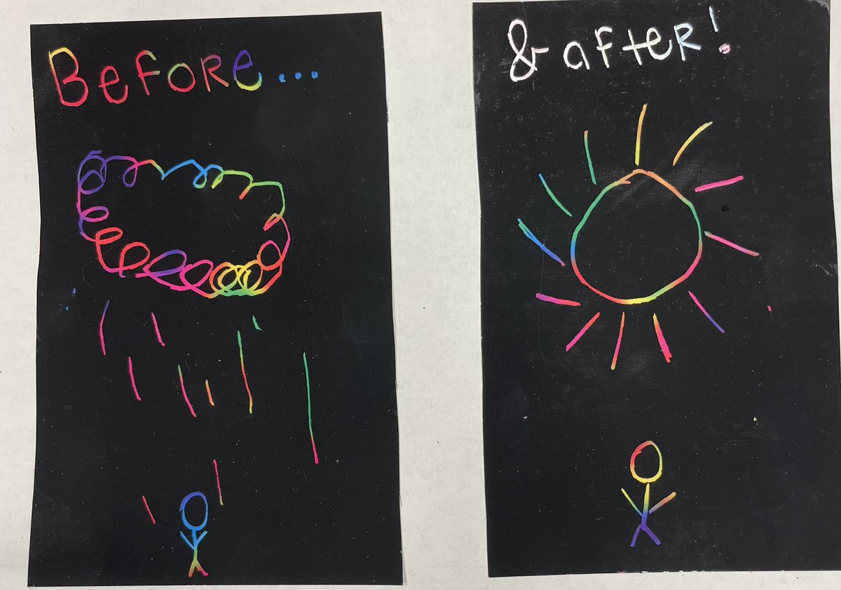 How a young girl felt before and after treatment for juvenile dermatomyositis @curejm @Duke_Childrens @annreed