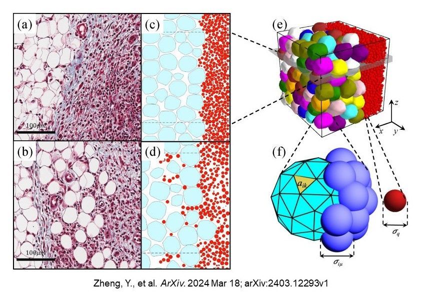 In a study supported by @CornellPSOC, Zheng et al. developed a #ComputationalModel of the physical features that affect #BreastCancer invasion @arxiv ncbi.nlm.nih.gov/pmc/articles/P….