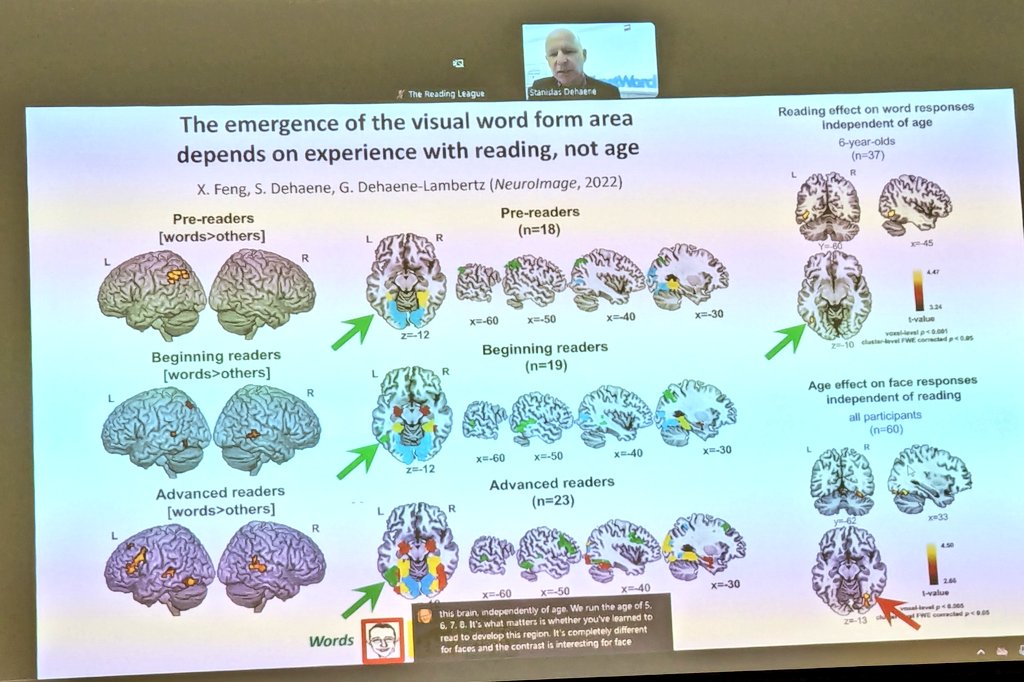 Learning to read increases the connection among parts of the brain. It is fascinating to notice the growth of connection #color in a child's brain while attending school. @StanDehaene Me 💭 This is a great reason to send children to school in an early age. #TRLSummit2024