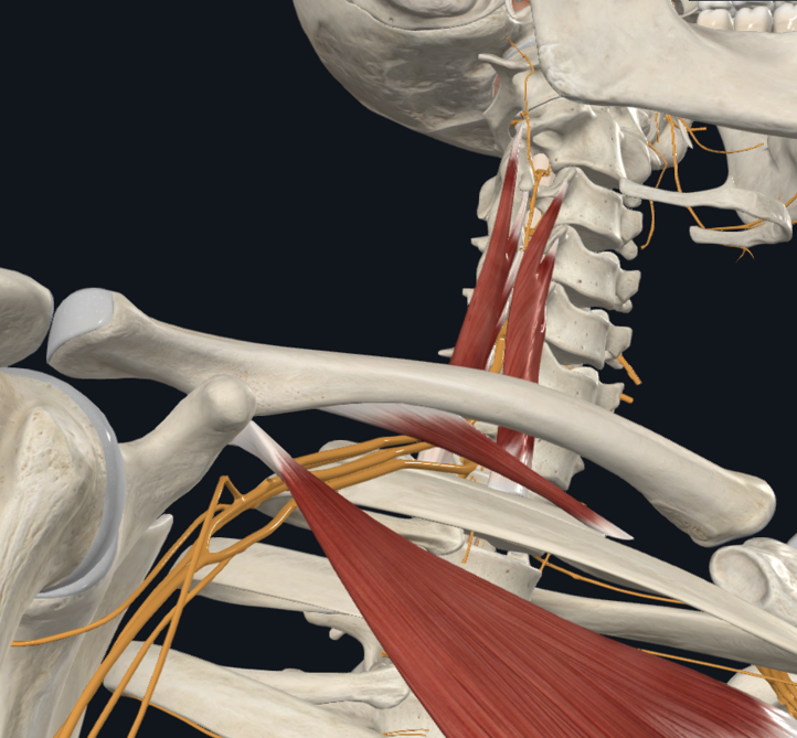 Just published, must watch! Comprehensive review on Thoracic Outlet Syndrome (TOS): youtu.be/ywMmjYXwTMY #thoracicoutletsyndrome #Neckpain #Shoulderpain #brachialplexus #painphysician