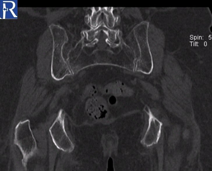 radiologybmj tweet picture