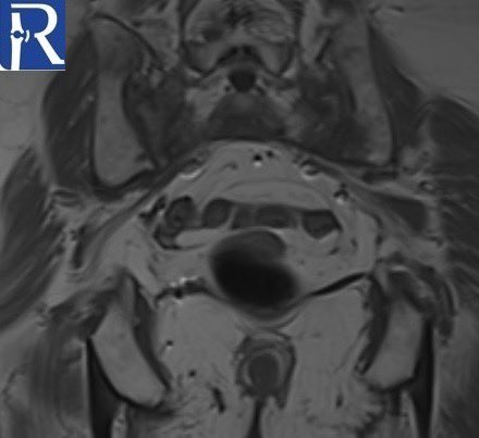 radiologybmj tweet picture