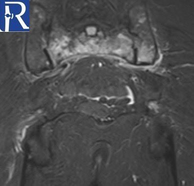 radiologybmj tweet picture