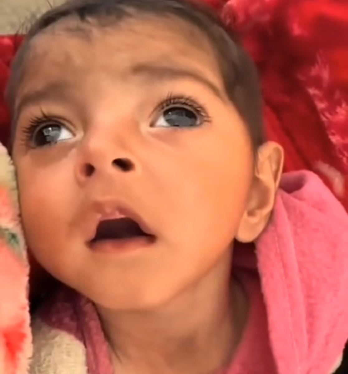Emelia8z0's tweet photo. What's starving Children looks like take a good look https://t.co/yVMRqGYnQV