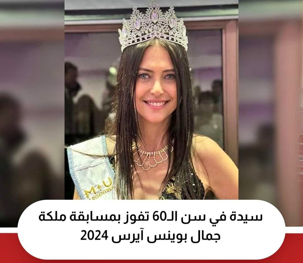 ElsabaghNermin's tweet photo. اكيد لسة الامل موجود.🤣
يارب لما اوصل لسنك ده اكون بهذا التألق 🥰
#MyTarget 🍒 https://t.co/z9AjxUBYGA