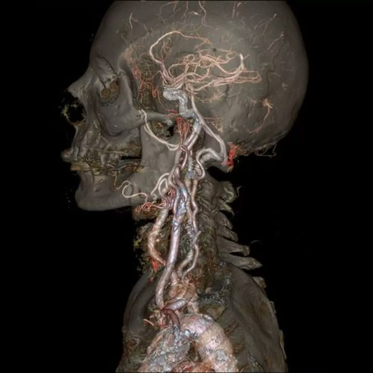 🧵 Explora el interior del cuerpo humano a través de estas impresionantes imágenes y GIF que muestran órganos, tejidos y sistemas. Estas representaciones visuales ofrecen una perspectiva única de la anatomía humana. 👇