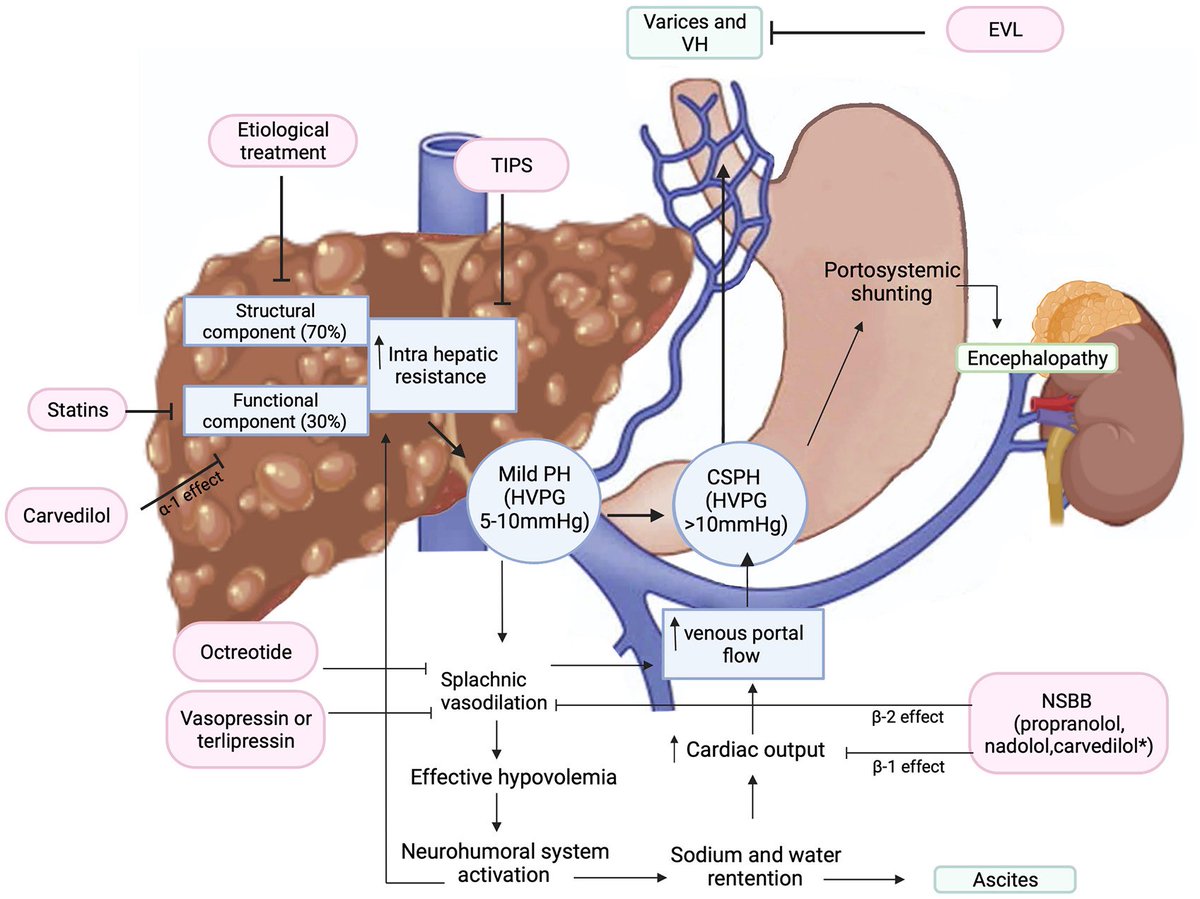 Management of varices and variceal hemorrhage in #liver #cirrhosis: a recent update @SAGEPublishers 

h/t @CritCareReviews

journals.sagepub.com/doi/full/10.11…