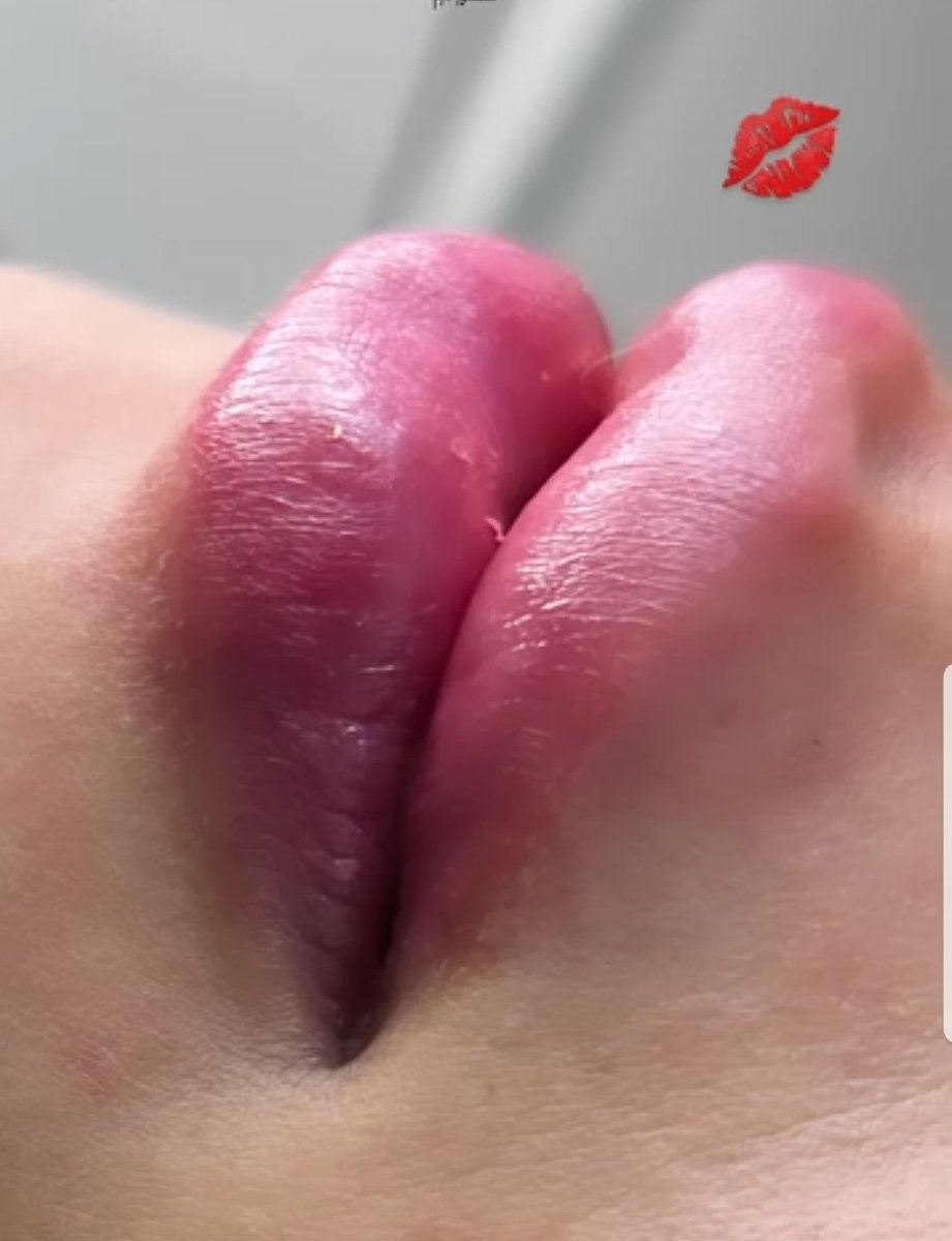 narmin611's tweet photo. my lips😘😘 https://t.co/5KdgnXvCpY