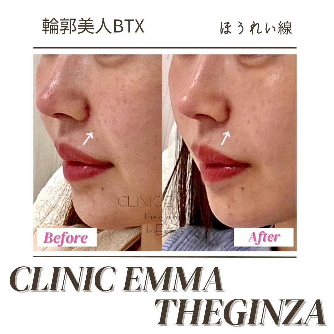 CLINIC_EMMA tweet picture