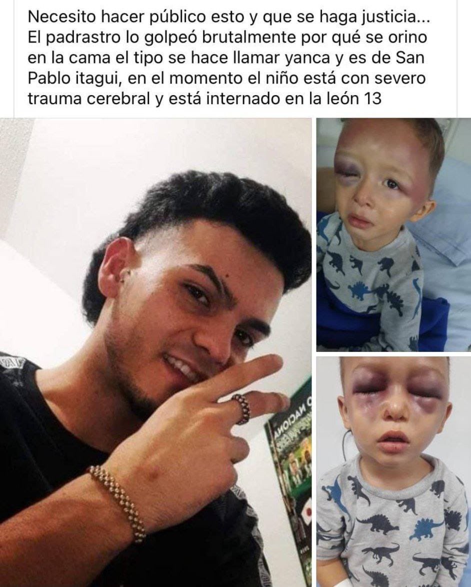 ¡Maldito! Terminando el día Día del niño un desgraciando golpeo brutalmente a un niño de 3 años al aparecer por orinar la cama, el niño está hospitalizado con severos traumas y el desadaptado enfermo es buscado por las autoridades de #itagui donde ocurrieron los hechos