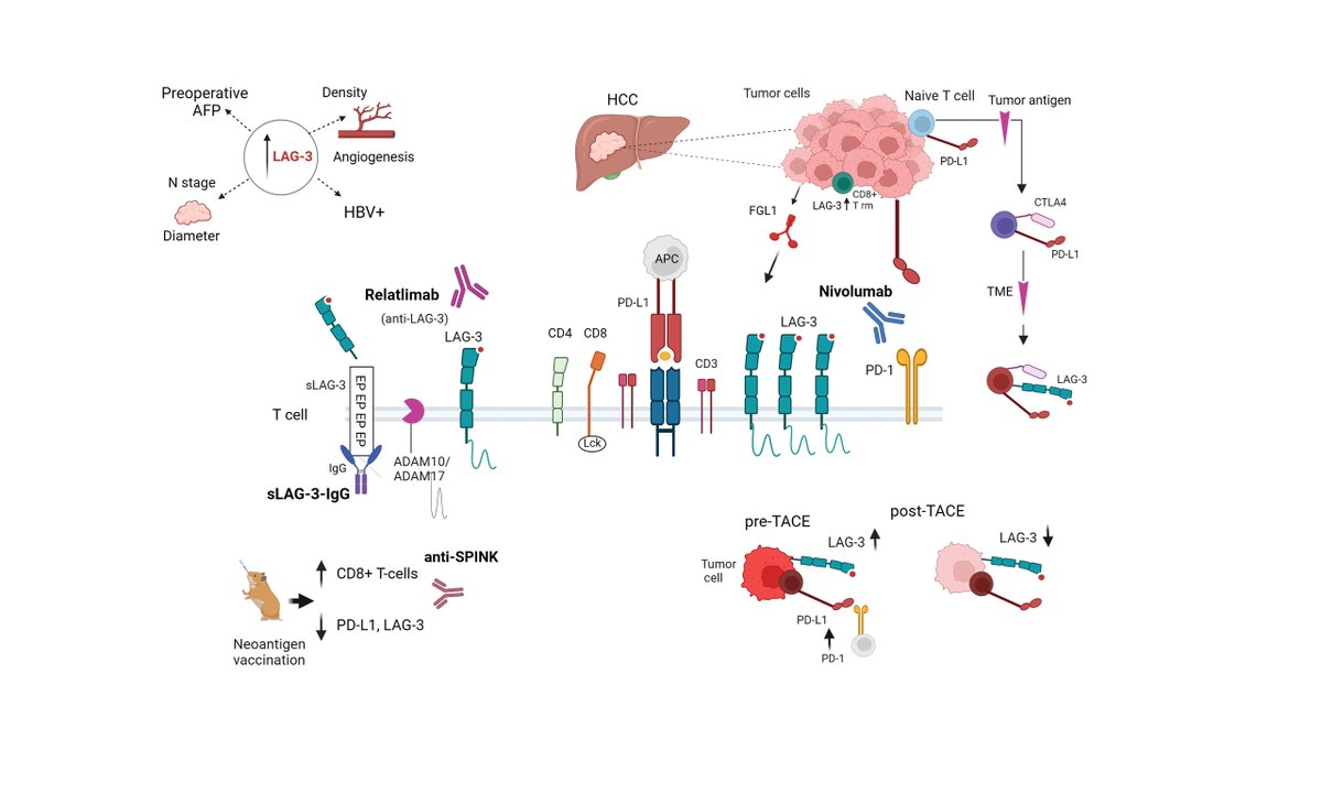 🔥 🔥 <Hot off the Press> Topic: Shedding light on the role of LAG-3 in #HCC: unraveling #immunomodulatory pathways #LiverTwitter #MedEd 🔎 Full text: f.oaes.cc/xmlpdf/fbdf4ef… Team: Aristotle University of Thessaloniki and National and Kapodistrian University of Athens.