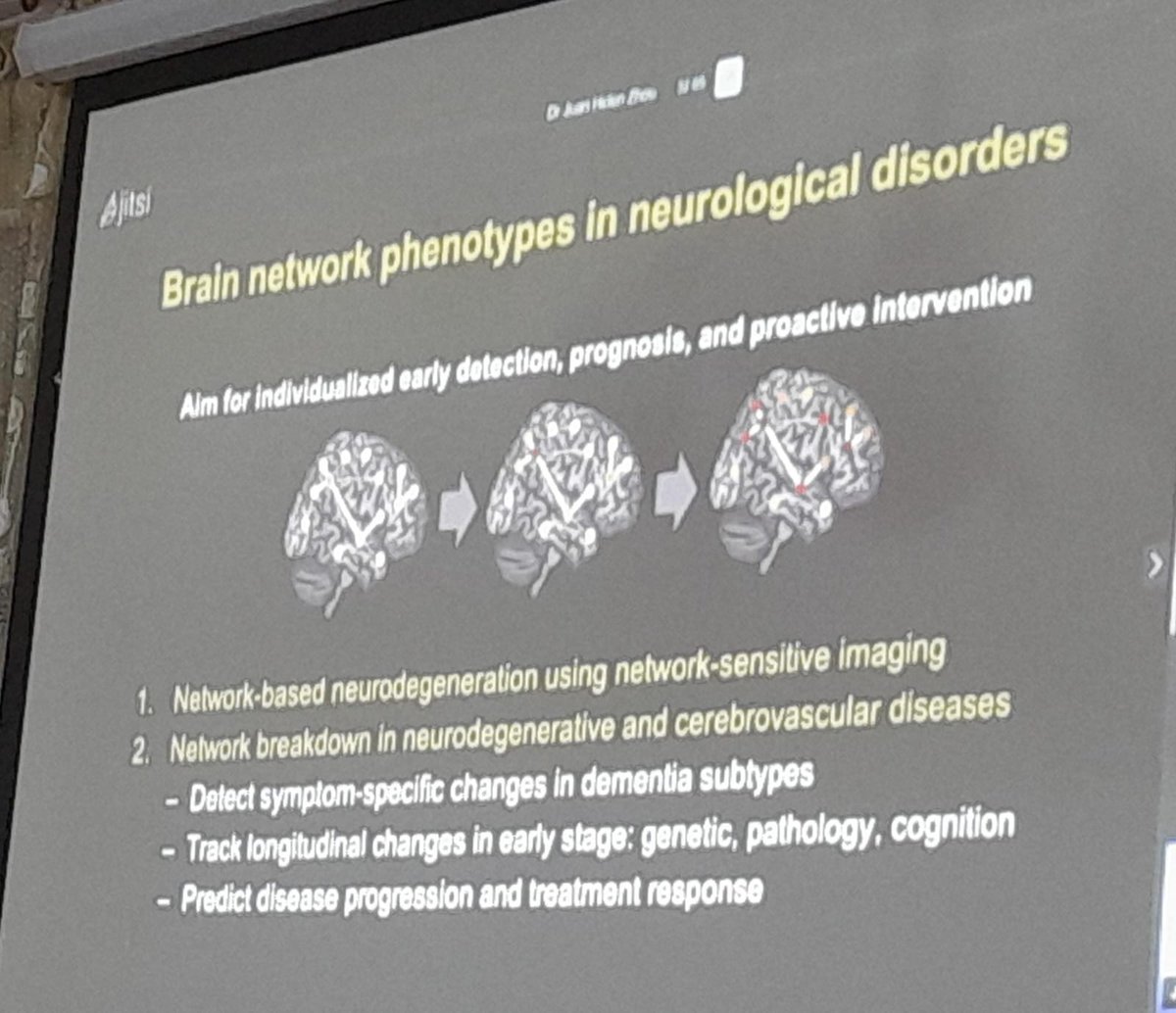 Developing personalized early detection for Alzheimer's Disease & other neurodegenerative diseases using brain imaging to identify changes in neural networks. Higher free water associated w/ longitudinal cognitive decline. @HelenJuanZhou @NUSingapore in @IBROorg Nepal School