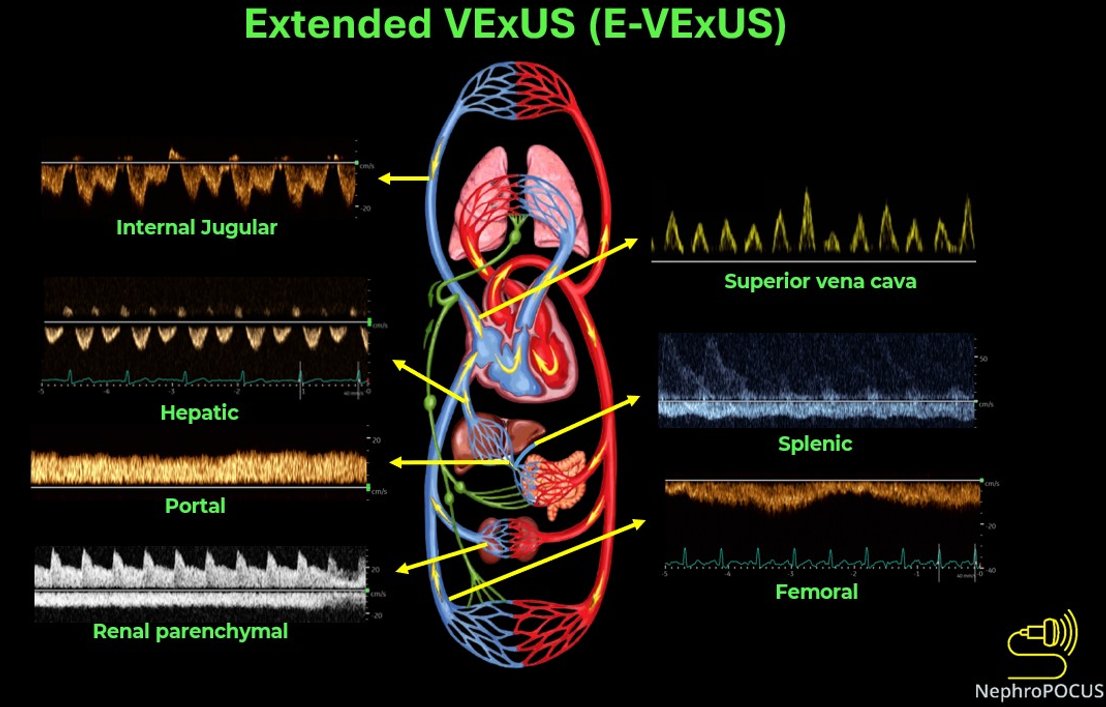 NephroP tweet picture