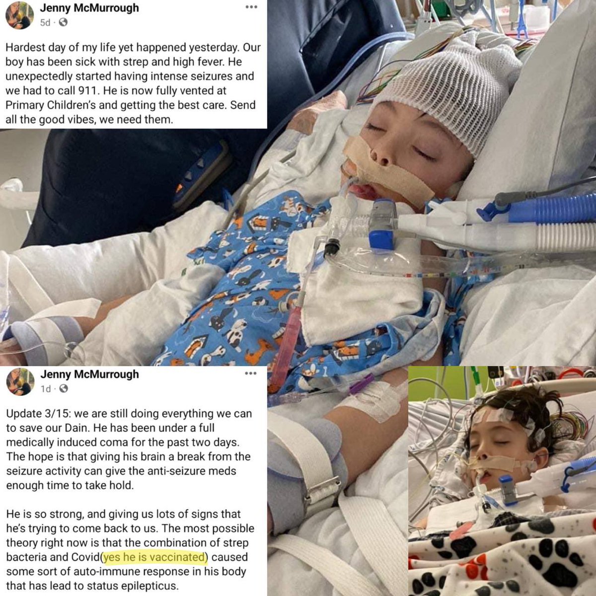 A young vaccinated boy is battling for his life. 
Mom says it appears to be some sort of autoimmune issue caused by Covid and strep bacteria. ☹️