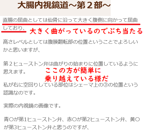 prostate727's tweet photo. 仙骨曲

ディルドを挿入すると痛くなり奥へ進まない
ひだがあるのでそれをやり過して奥へと進め
というのが一般的だが私の感覚は違う

仙骨が壁になっている
一旦休んだ少し戻してピストンしたり体勢を変えたりいきんだりすると奥に進む

この仙骨曲側がとても気持ちいい
＃ドライオーガズム ＃アナル https://t.co/MPi8MizoAy