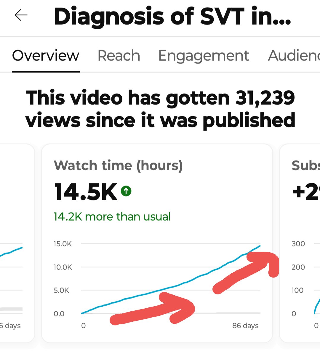 🤯 So it seems the 'SVT Diagnosis' video fit an unmet need! ➡️ >30,000 views in 3 months ➡️ *Increasing* view time per watch ➡️ *Average* view time > 40 minutes lately (!), even factoring in those who click it for a brief moment but don't watch right then I'm beyond thrilled 🙏