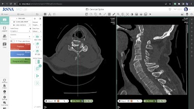 In-depth analysis of the challenges and processes of organizing medical imaging AI competitions doi.org/10.1148/ryai.2… @FelipeKitamura @kalpathy1 @RSNA #DeepLearning #MachineLearning #competition