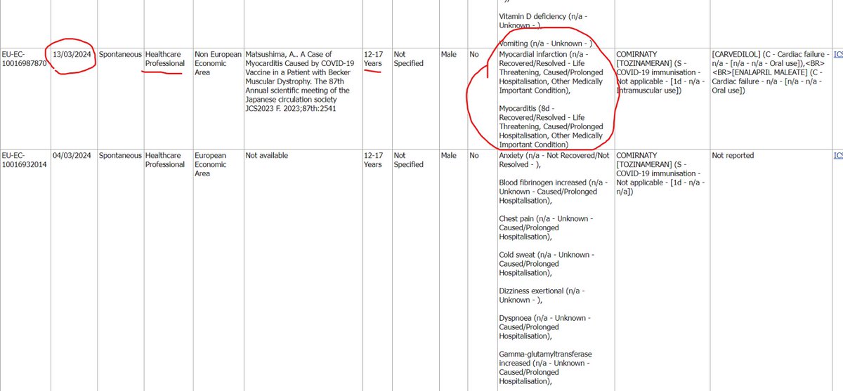 13/03/24 ⬇️
Healthcare professional reports are recording 12-17 year olds having life threatening events after the #Pfizer #mRNA vaccine;

Myocardial Infraction (heart attack)
Myocarditis

adrreports.eu/en/index.html