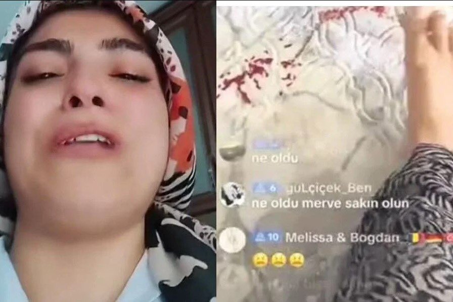 TikTok’ta, çocuğunun başı yaralıyken canlı yayına devam edip para isteyen sözde anne hakkında soruşturma başlatıldı.