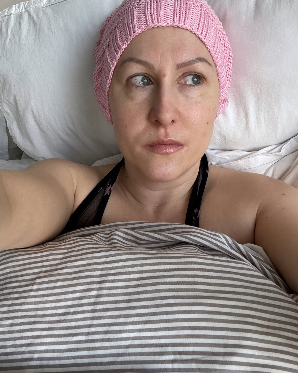 Woke up to a new morning (slept bareheaded). I don't like my shaved head but with a beanie it's ok.
#cancer #breastcancer #cancerawareness #breastcancerawareness #myday #mylife #hairday #fuckcancer