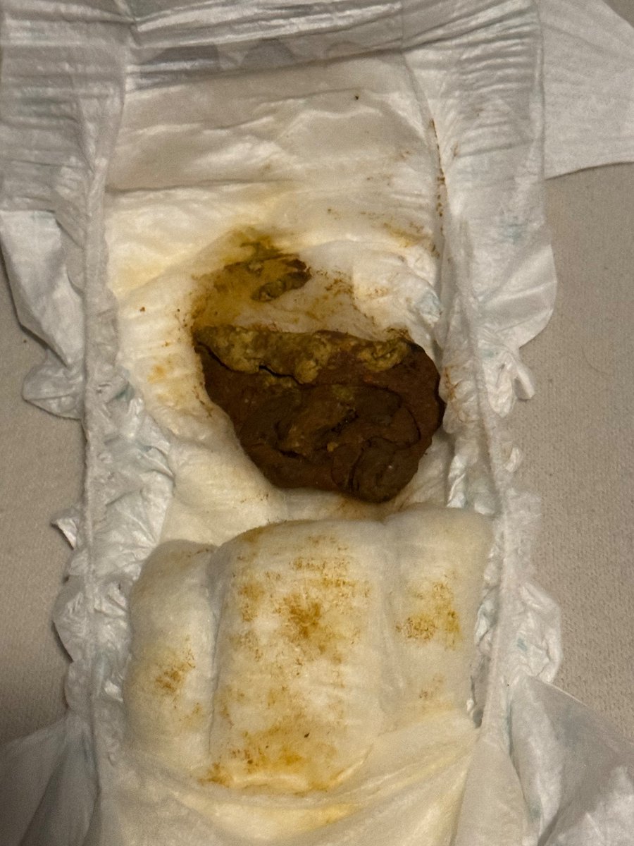 Diaper6662's tweet photo. Poo diaper found @ Queensday https://t.co/JkBm4SEGH4