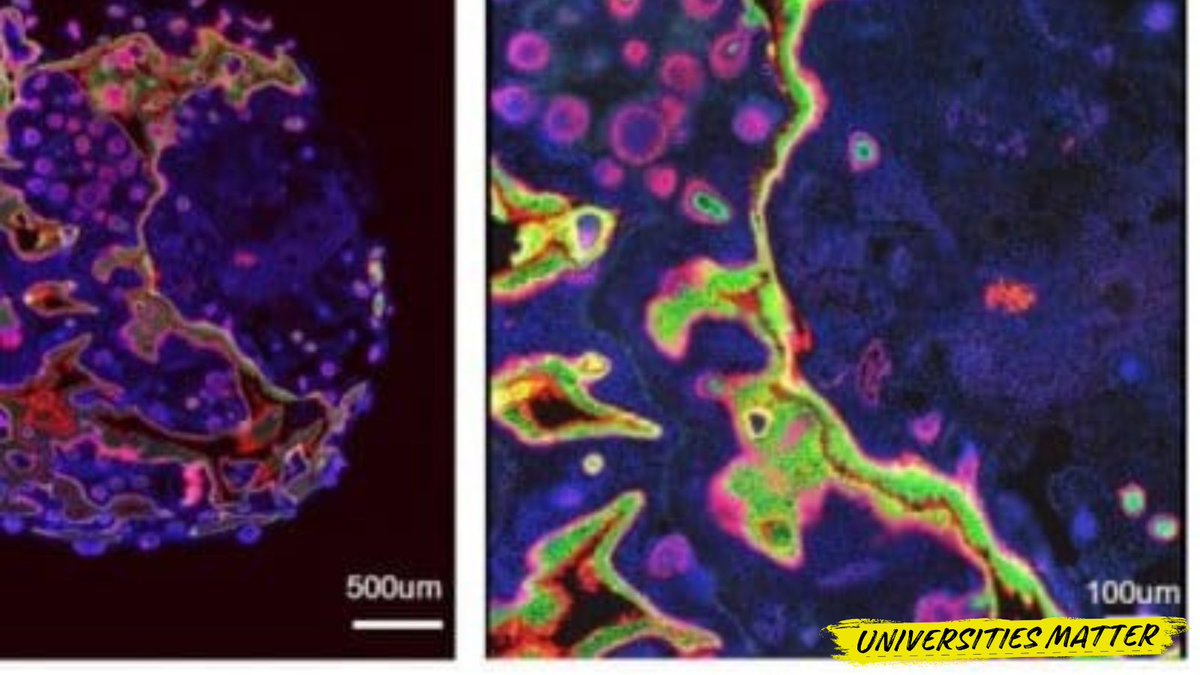 .@UQ_News researchers have become the first in Australia to use human stem cells to generate fully functioning skin tissue in a laboratory. The generated skin mimics the human body more closely than existing skin substitutes and is a major advancement for treating severe burns…