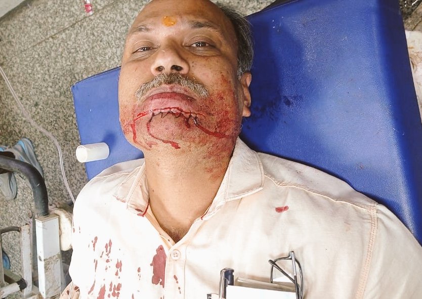 . #पत्रकार कवि तिवारी पर हुआ जानलेवा हमला। योगी जी? #UP से माफिया भाग गए हैं या तो मार दिए गए हैं? 👉🏾 गले को धड़ से अलग करने का किया गया प्रयास लेकिन वार थोड़ा ऊपर हो गया। #Lucknow कमिश्नरेट पुलिस द्वारा कार्यवाही में की जा रही खाना पूर्ती।पत्रकार सिविल अस्पताल में भर्ती।