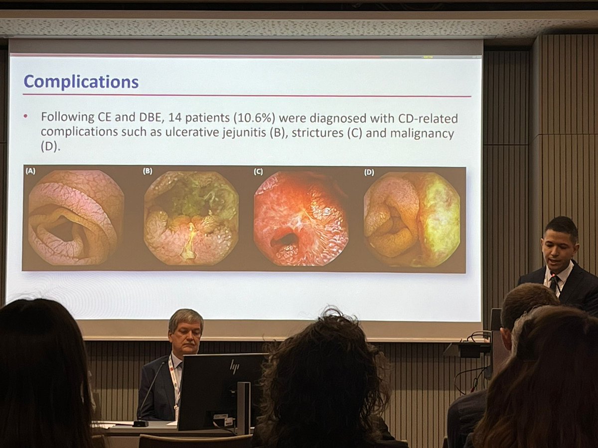 Excellent talk by @Mo_Shiha on #capsule #endoscopy in patients with #coeliacdisease @ #ESGEDays2024 . Well done!