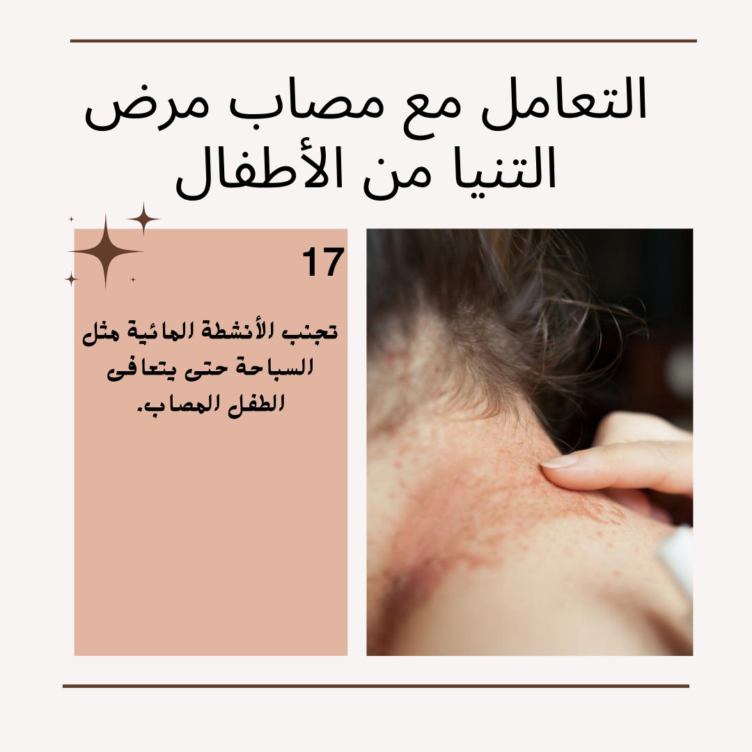 الوقاية من الحصبة: لقاح واحد يحمي طفلك! #طبيب_اطفال #نصيحة_من_طبيب_الاطفال #الحصبة