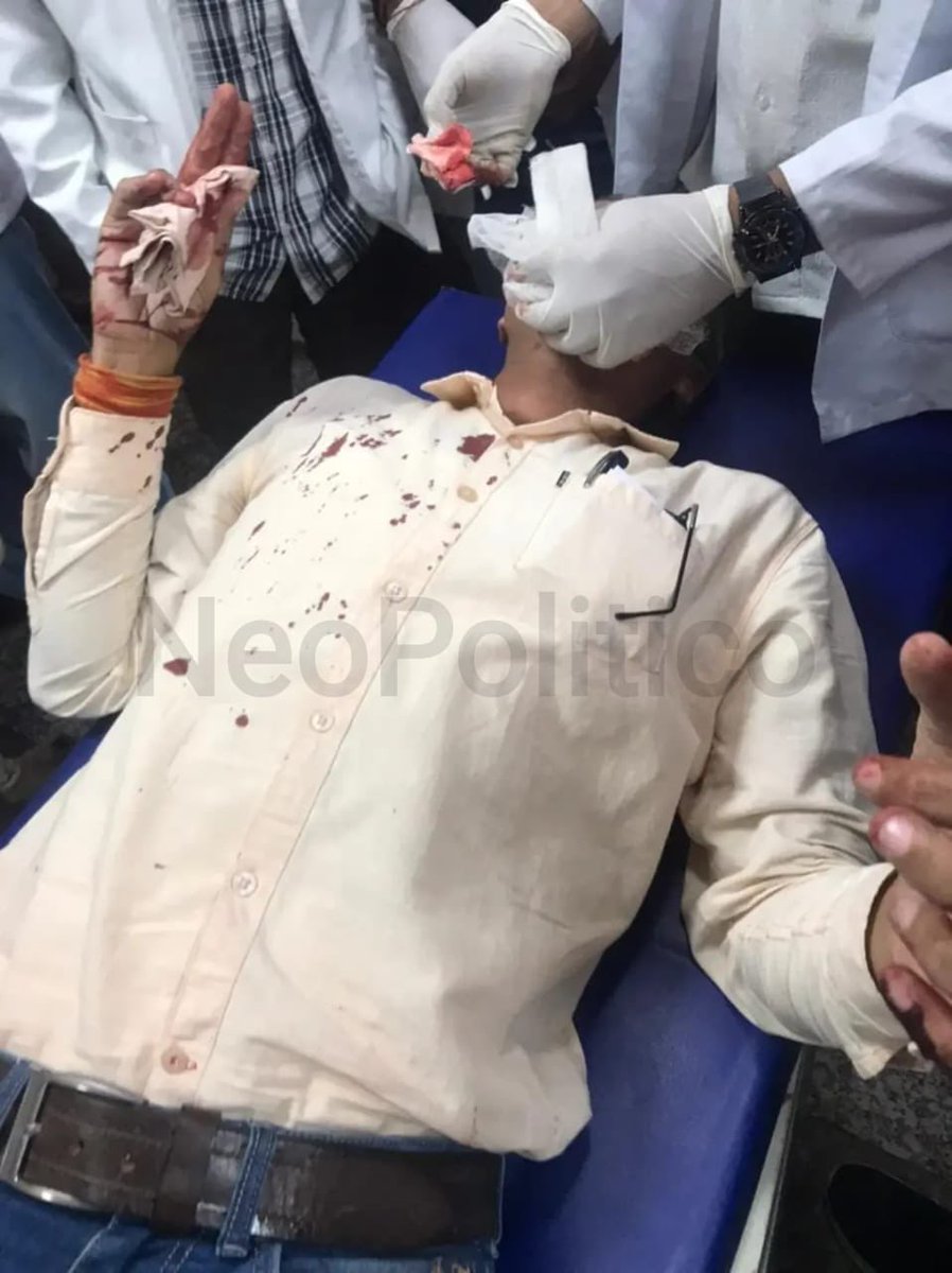 Now its risky to do ground reporting in any where in India ?
Lucknow, UP : Hindu Journalist Kavi Tiwari attacked , his fingers and mouth ch0pped with sharp knives by Mohammad Monis, Mohammad Ehsan and other 4-5 accused when he was going to mandir. He was attacked for showing…