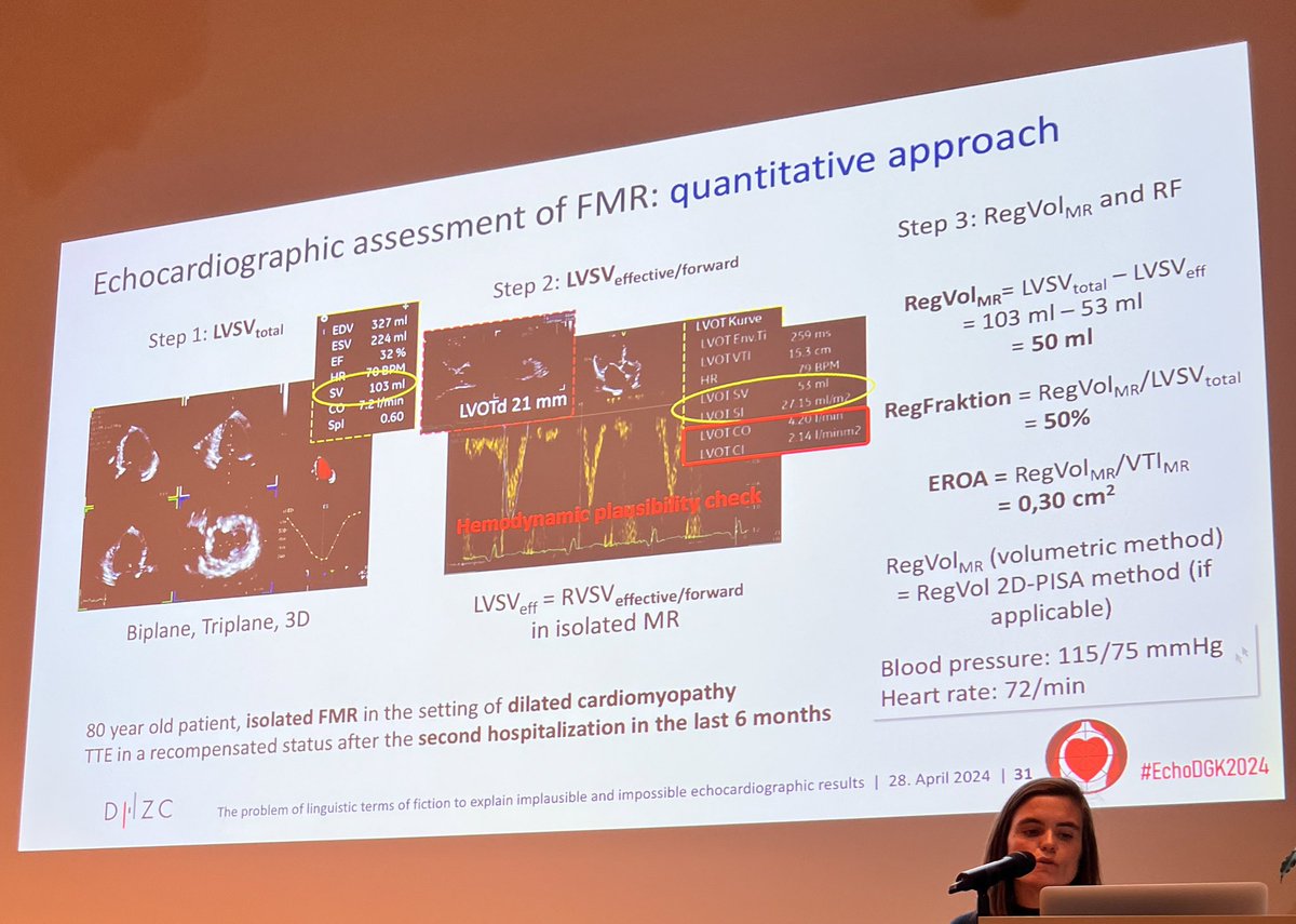 iamritu's tweet photo. @eromerodorta brilliantly dissects #Coapt #MitraFR
#EchoDGK2024 #echofirst
Coapt: LV forward volume
-9ml with RF 118% & does not explain disproportionate MR
Don’t repeat the story of measuring errors
"Education is the most powerful weapon which you can use to perform transparent & verifiable analysis of MR
severity .”
“When quantifying MR, we must stay humble” @echo_batman Make your FMR proportionate & use common sense!