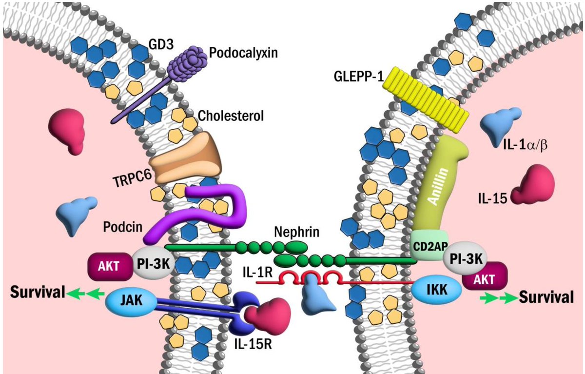 New from Maria E. Kovalik, @htn_StevenC and Dr Gentzon Hall in @Biomed_MDPI Swollen Feet: Considering the Paradoxical Roles of Interleukins in Nephrotic Syndrome mdpi.com/2227-9059/12/4…