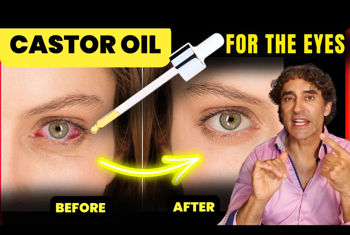 Castor Oil  // Dry Eye, Dark Circles, Cataracts, Floaters and MORE!! youtu.be/RfYfqeXJOig?si…