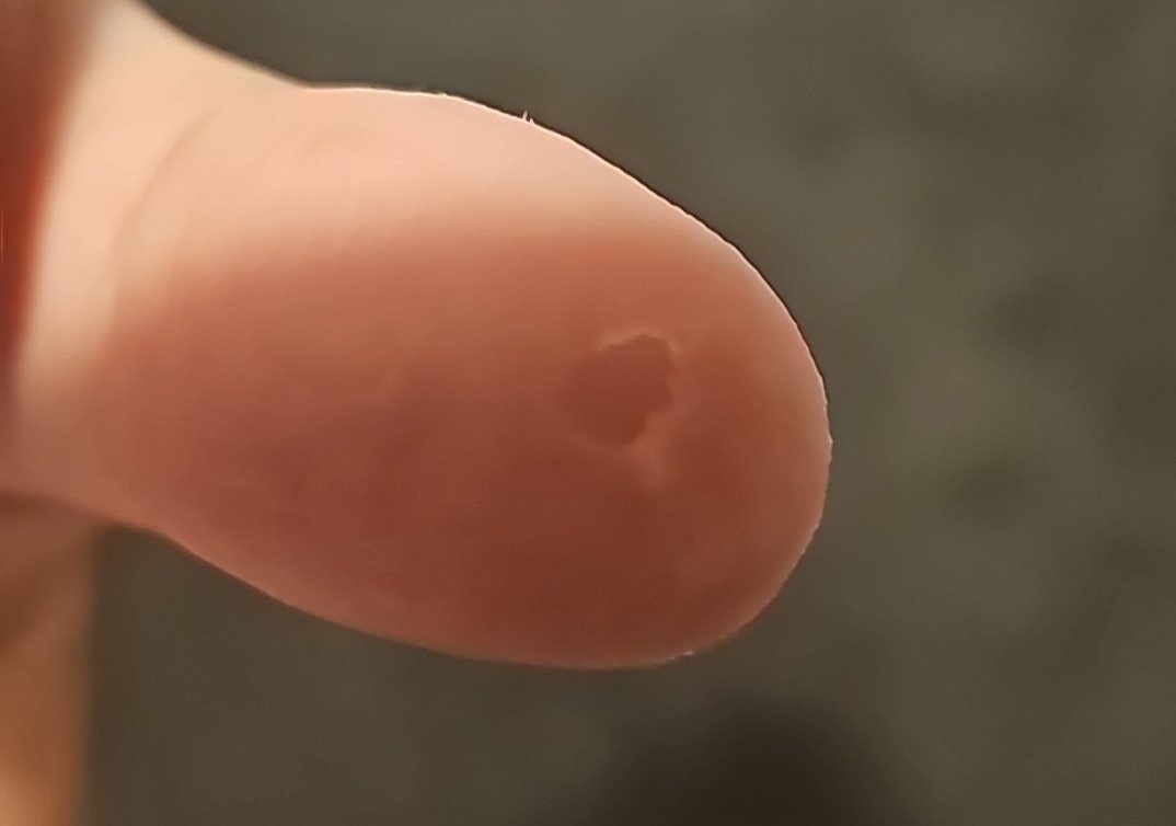 What the fuck has hollow knight's path of pain done to my thumb