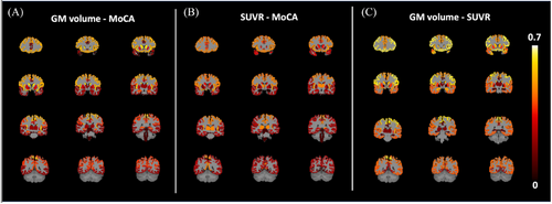 Both #neuroimaging functional PET and structural gray matter volume predict #memory in frontotemporal #dementia. #neuroscience #neurology #neurotwitter #brain Learn how using both helps! onlinelibrary.wiley.com/doi/10.1111/jo…