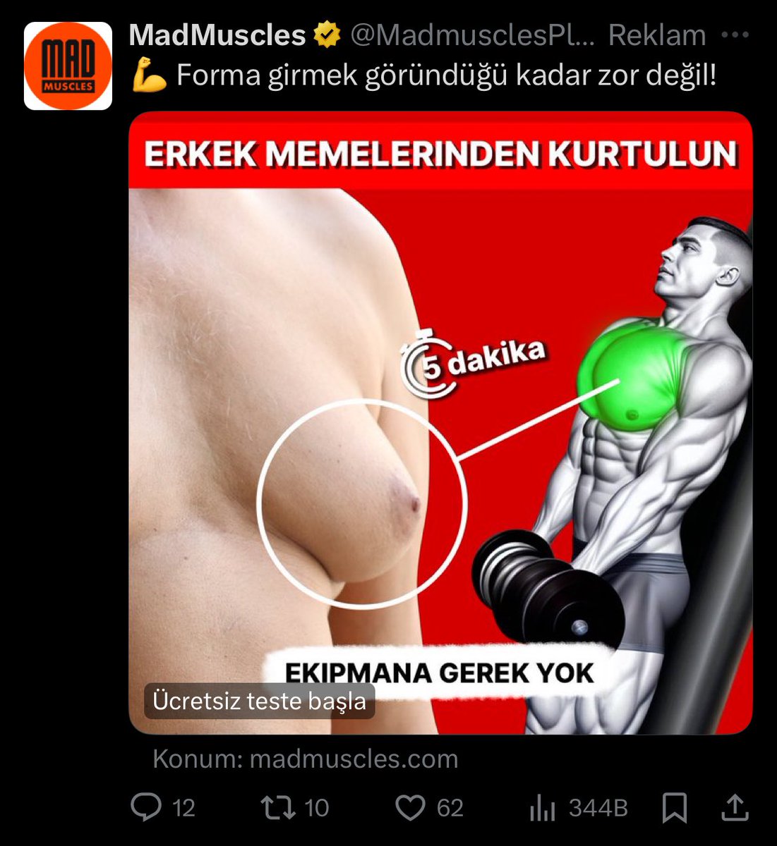 Ben niye taymımda steroidi bıraktıktan sonra 2 yıl dinlendirilmiş, sir ağda yapılmış ve daire içine alınmış bir erkek memesi görüyorum