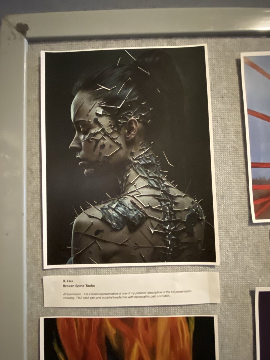 NatashaLeighOrr's tweet photo. Really powerful art exhibit about living with chronic pain #CanadianPain24 ⁦@CanadianPain⁩ https://t.co/FldaNj7xaR