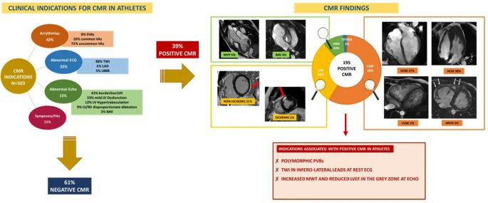 The role of cardiac magnetic resonance in sports cardiology: results from a large cohort of athletes link.springer.com/article/10.100… #athlete #cardiomyopathie #MRI #SportsCardiology