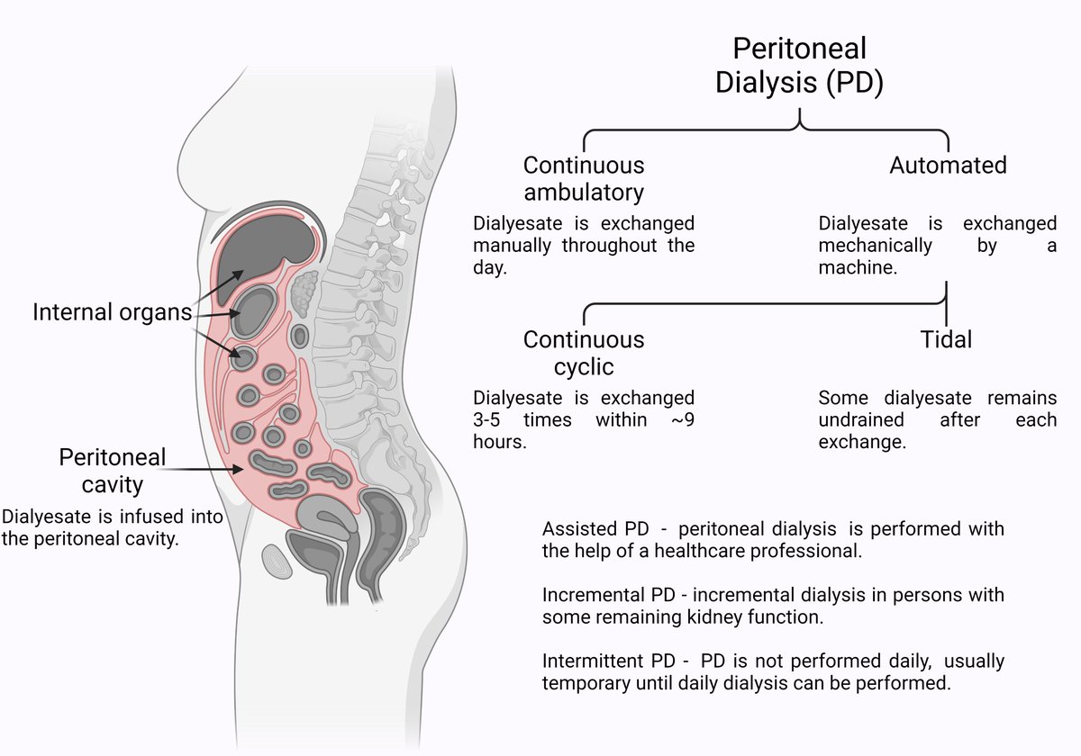 Exploring essential #PeritonealDialysis terminology, view also at qaiswsaleh.com/exploring-esse…