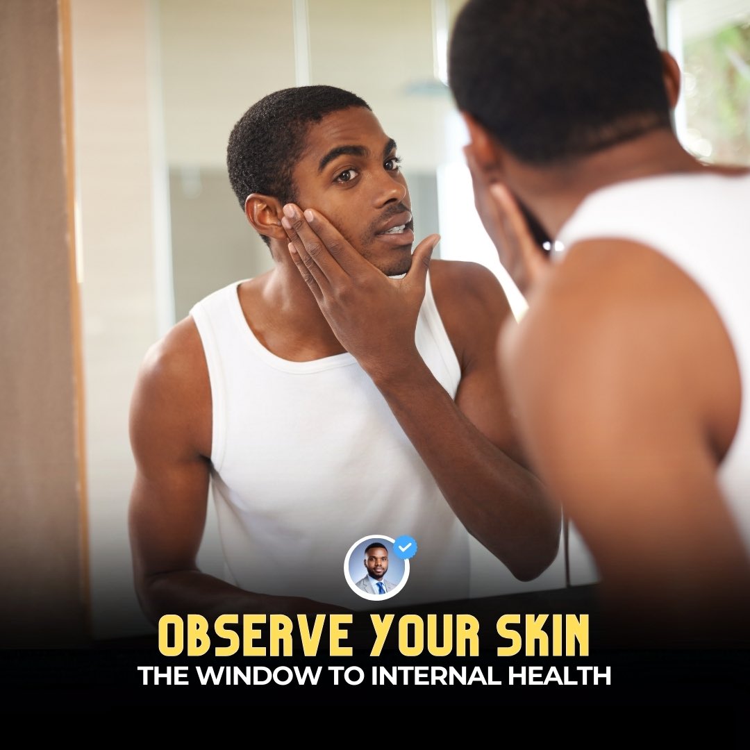 Did you know that your Skin often acts as a window to your body's internal health, showing various conditions that may not totally be skin-related Here are five disease-related reasons why you should monitor your skin A thread